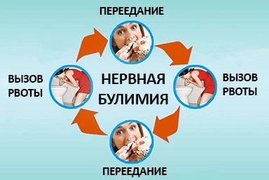 Лечение булимии в Александровском